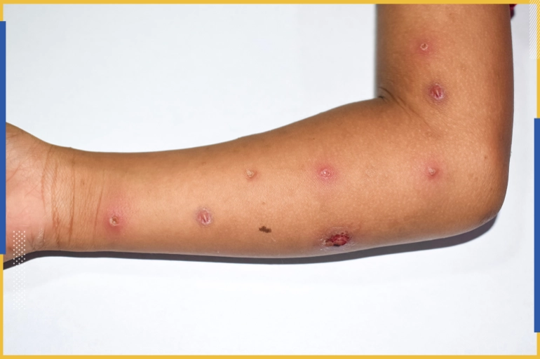 1-347_628eb0b268d41 1-347_628eb0b268d41