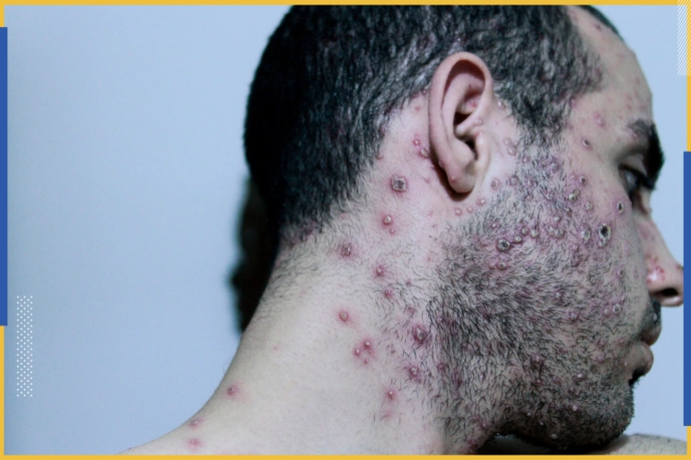 1-348_628eb0b6b7c19 1-348_628eb0b6b7c19