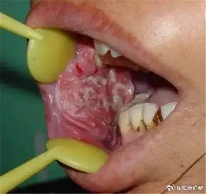 6896009593bbb-20250808-104531-689637bbd7fe5 6896009593bbb-20250808-104531-689637bbd7fe5